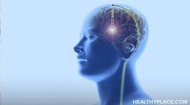 Deep brain stimulation is a form of surgical treatment. It can be effective for treating brain disorders, but what are the risks? Find out on HealthyPlace.